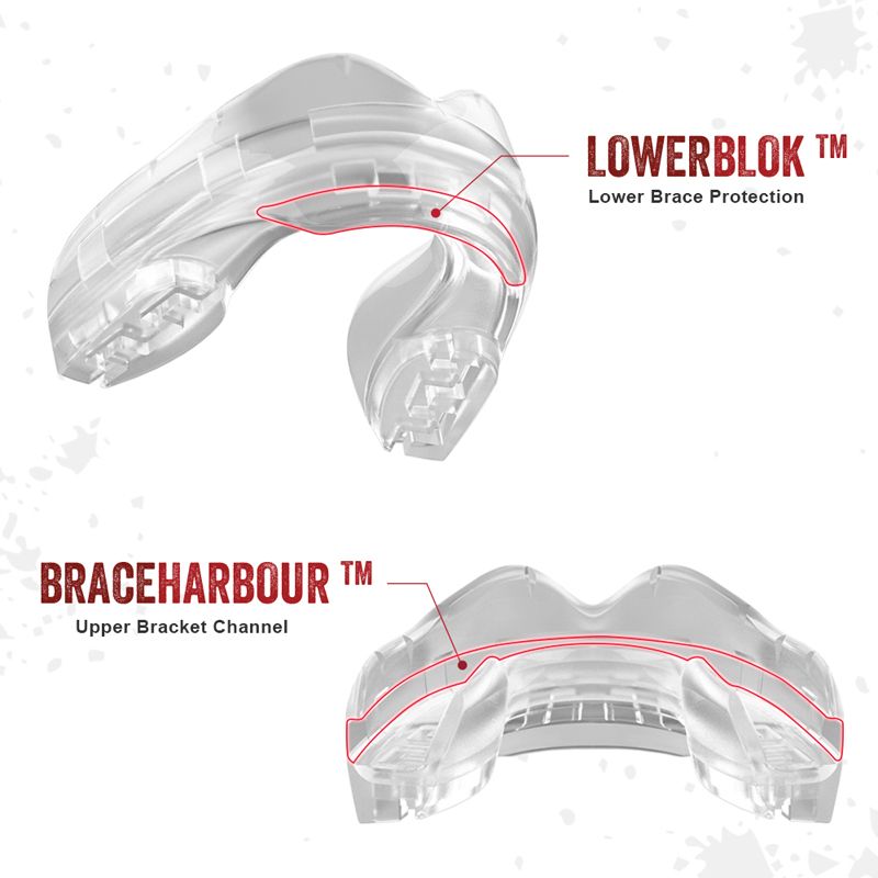 Mondbescherming voor beugel met opbergdoosje